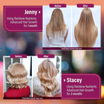 🧬 HAIR GROWTH - 🌿💫 Detén la caída y activa el crecimiento REAL de tu cabello+ENVÍO GRATIS